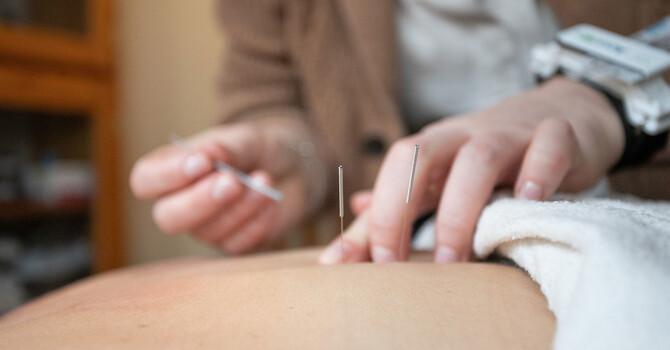 Acupuncture & Holistic Health Services